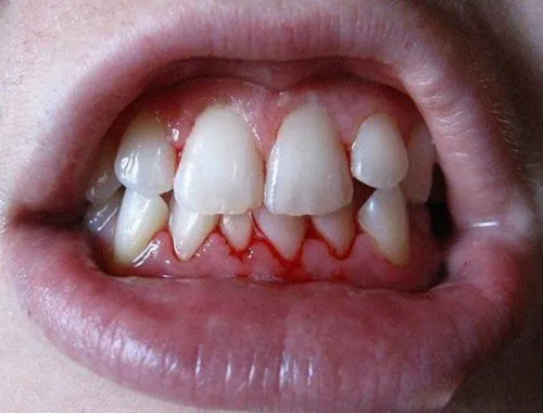 круглая зубная нить